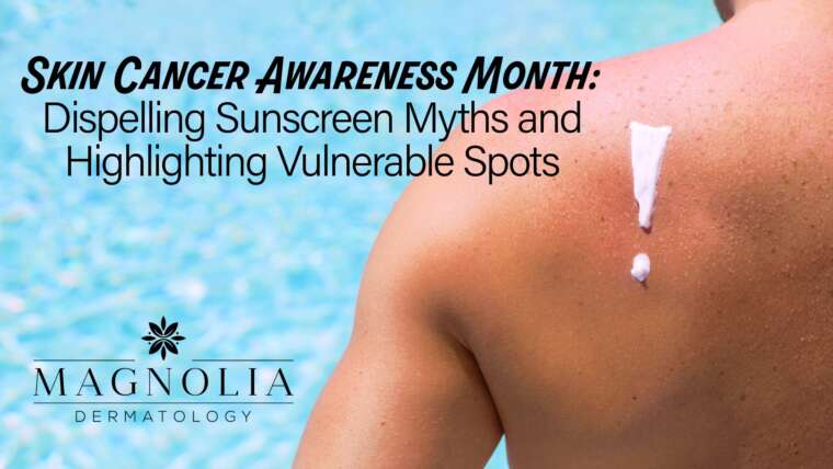 Skin Cancer Awareness Month: Dispelling Sunscreen Myths and Highlighting Vulnerable Spots