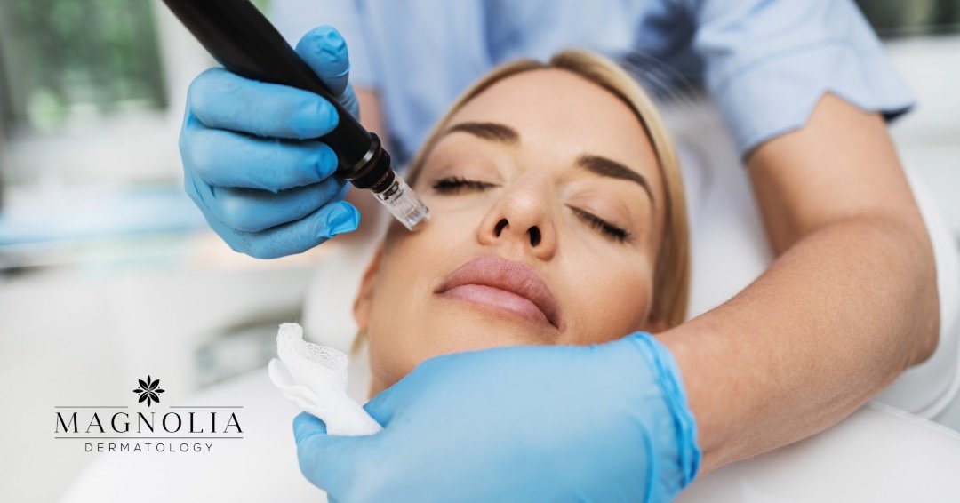 Microneedling