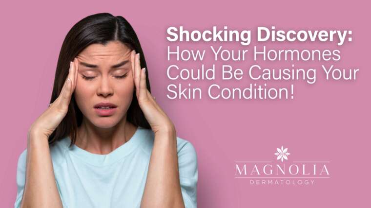 Shocking Discovery: How Your Hormones Could Be Causing Your Skin Condition!